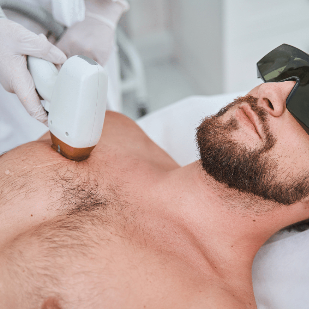 PRO Wave LX: Láser hair removal FULL BODY