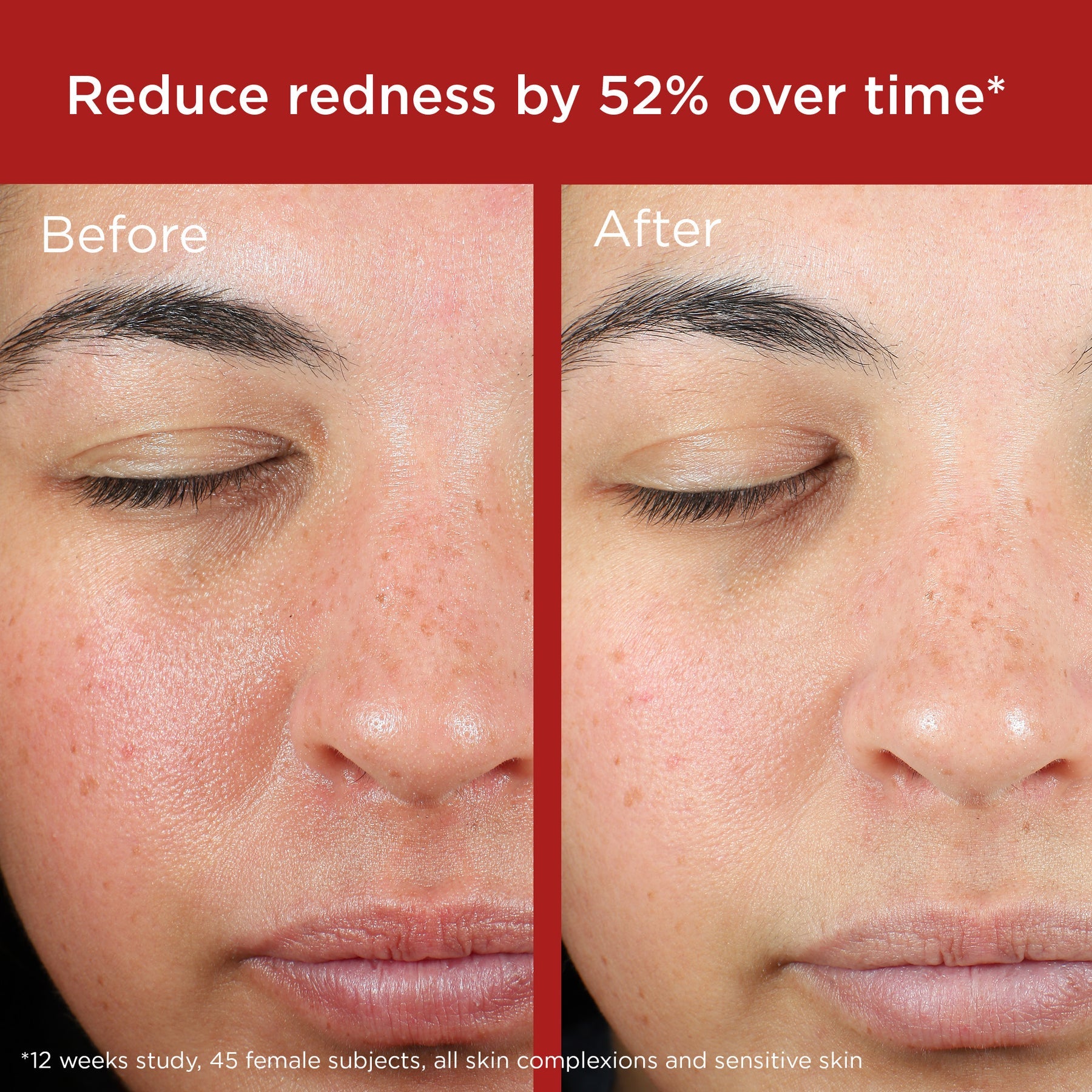 UV Skin Recovery SPF